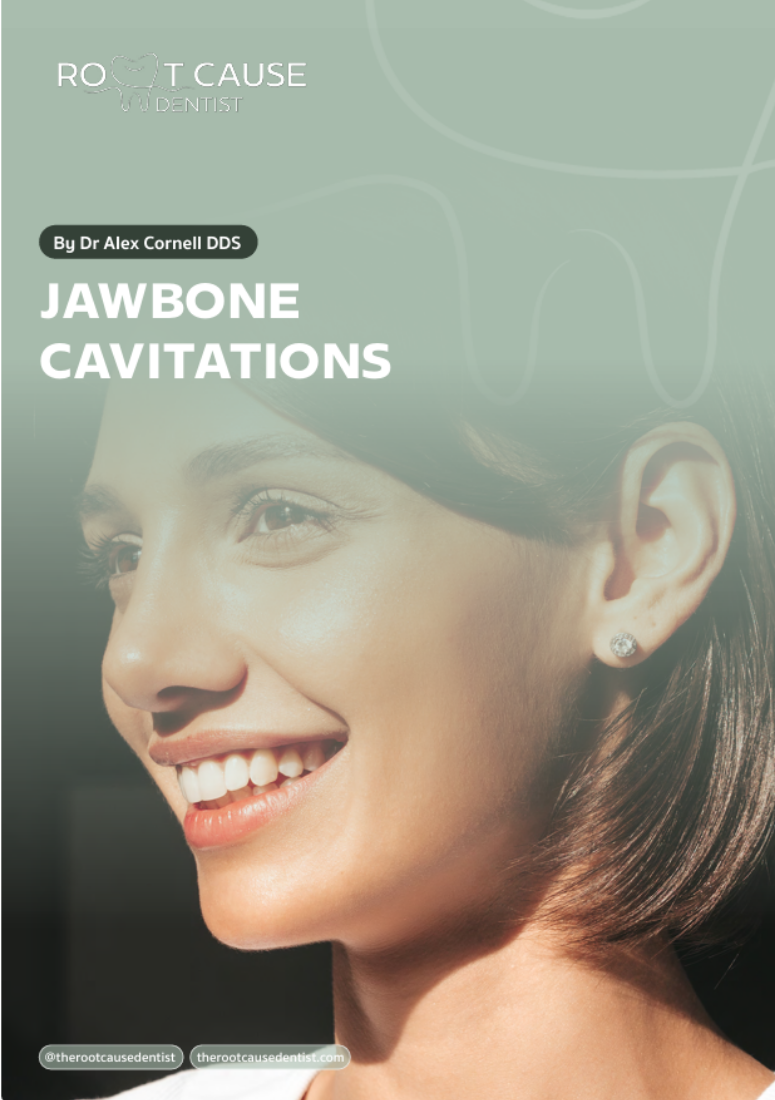 jawbone cavitations