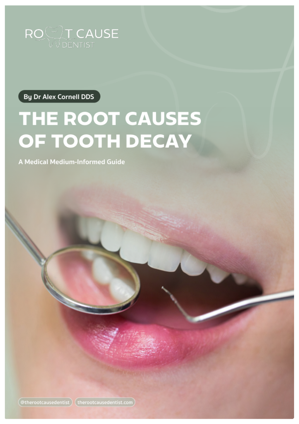 root causes of tooth decay
